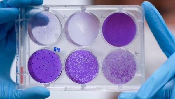 Coronavírus: cientistas brasileiros preparam teste de medicamento que reduz carga viral em 94%
