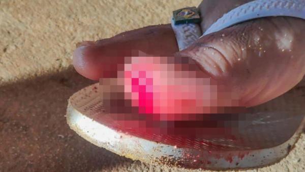 Corpo de Bombeiros Militar registra atendimentos a vítimas de ataques de piranhas e arraias