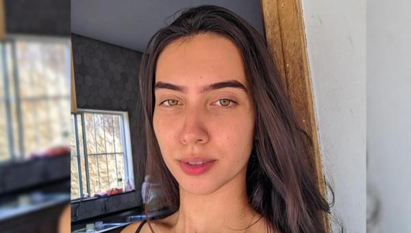 Estudante de Ananás sofre acidente em uma via mal sinalizada em Araguaína