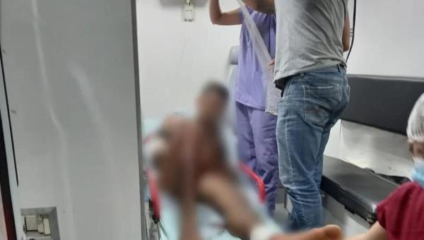 Homem é baleado com quatro tiros enquanto andava na rua em Darcinópolis 