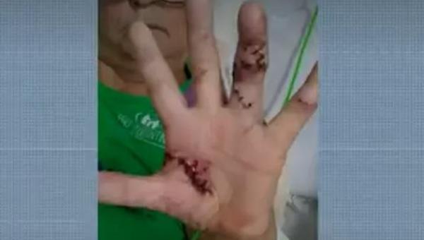 Idosa conta que fingiu de morta para escapar de agressor após 13 facadas