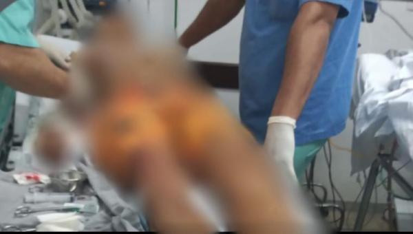 Jovem é esfaqueado em praça pública, e adolescente leva tiro enquanto caminhava com amigo 