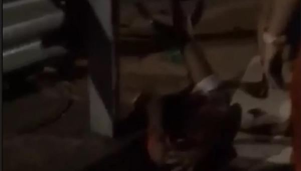 Jovem sofre fratura ao cair de bicicleta enquanto pegava rabeira na traseira de caminhão