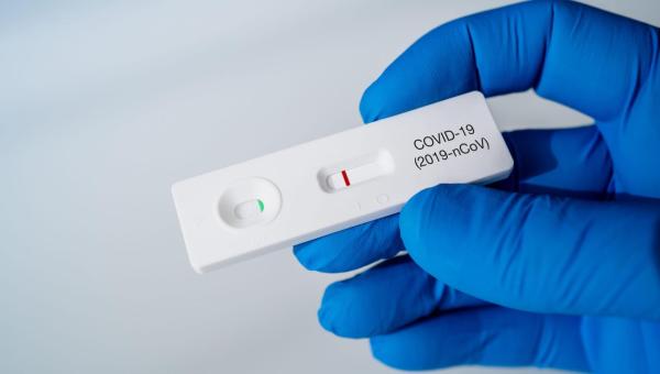 Procura por testes de Covid-19 cresce em Palmas após aumento no número de casos