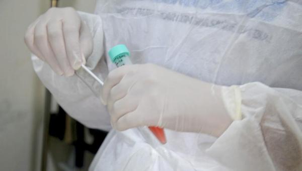 Seciju e Secretaria Municipal de Saúde promovem testagem para detecção da covid-19 na Unidade de Semiliberdade Feminina de Palmas