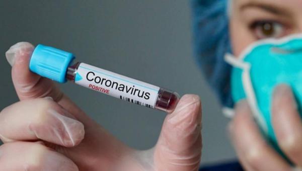 Palmas agora tem 9 pacientes com Covid-19; no total, Tocantins registra 10 casos