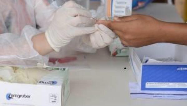 SAÚDE: Mutirão de testes rápidos para Covid começa nesta segunda-feira (15) em Palmas; veja os locais
