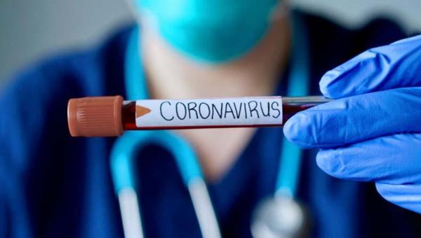 TO registra mais 769 infectados pela Covid e bate novo recorde com 482 pessoas internadas