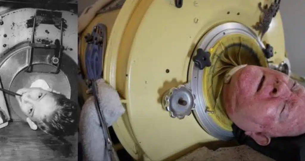 Esse homem vive há mais de 70 anos com um “pulmão de ferro”